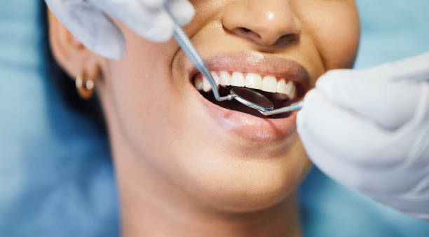 Best Chipped Tooth Repair Near Me  in Bigfoot, TX
